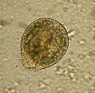 Balantidium është paraziti më i madh protozoar