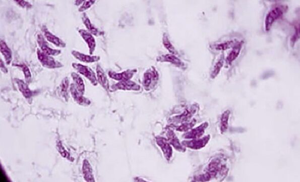 paraziti protozoar toxoplasma gondii agjenti shkaktar i toksoplazmozës