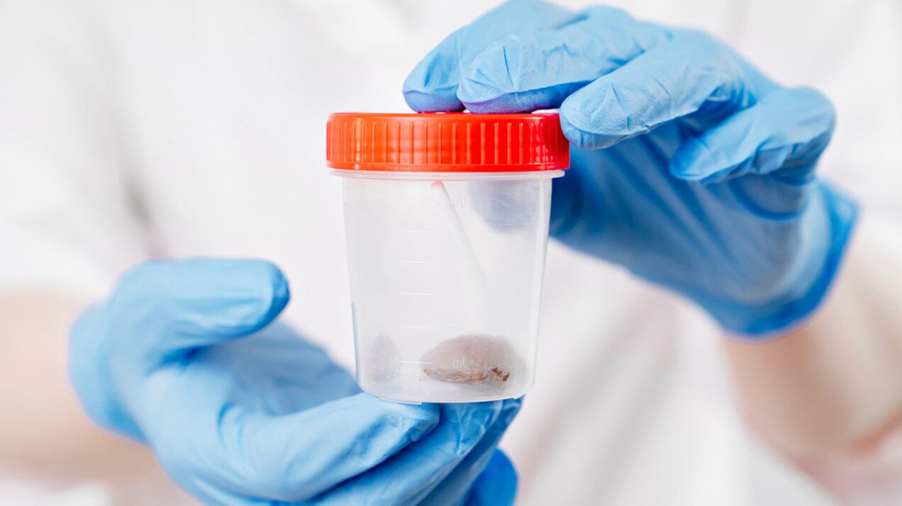 Testi më i thjeshtë që tregon praninë e krimbave është analiza e fecesit